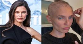 Kanserle mücadele ediyor! Dünyaca ünlü model Bianca Balti'nin son hali ortaya çıktı