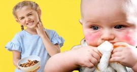 Uzman uyardı: "Besin alerjisi olan çocuklarda arkadaş ikramı hastanelik edebilir"