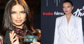 Adriana Lima yüz yağlarını aldırdı adeta bambaşka birine dönüştü!
