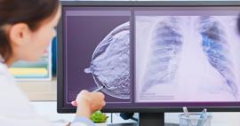 Kanser tedavisinde devrim: Kişiye özel tedavi dönemi başladı