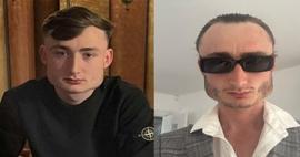 Boks tutkusu yüz hatlarını değiştirdi! Linx'in yüzündeki kalıcı deformasyon gündem oldu