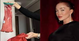 5. kez ameliyat olan Danla Bilic kalçasından çıkan dolguyu paylaştı: Görenler inanamadı