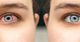 Uzmanı uyarıyor: Kış aylarında soğuk hava ve kapalı ortamlar, g&ouml;z sağlığını tehdit ediyor!