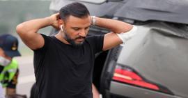 Alişan'dan beklenmedik botoks itirafı! 