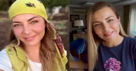 Burcu Kara'dan estetik &ccedil;ıkışı: Bazen kim olduğunu karıştırıyorum!