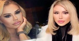 Ceylan'dan şaşırtan estetik uyarısı: Asla yaptırmıyorum!