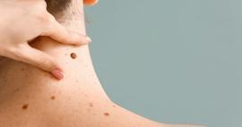 Uzman isim a&ccedil;ıkladı: &Ccedil;ocuklarda benler masum mu, risk sinyali mi? 