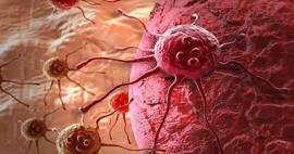 V&uuml;cudunuzun sessiz uyarıları: Kanser &ouml;ncesi belirtileri g&ouml;z ardı etmeyin!