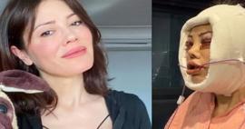 Y&uuml;z nakli olan Didem Ceran, son haline gelen "yapay zeka" yorumlarına yanıt verdi!