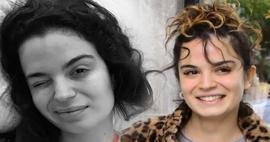 Aslı Bekiroğlu'ndan nazar isyanı: "D&uuml;z yolda d&uuml;şt&uuml;m kaslarım yırtık!"
