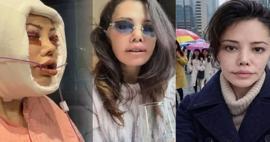 Kore'de y&uuml;z nakli sonrası &ouml;l&uuml;m dilekleriyle karşılaştı: Didem Ceran isyan etti