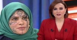 Y&uuml;z&uuml;ndeki d&ouml;vmelerle g&uuml;ndem olmuştu! Nazan &Uuml;nal'dan sunucu Didem Arslan Yılmaz'a şok su&ccedil;lama