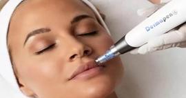 Cildi gen&ccedil;leştirmenin sırrı: Kadınların yeni g&ouml;zdesi kolajen arttıran dermapen işlemi!