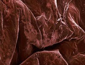Yiyeceklerin şaşırtıcı mikroskobik görüntüleri