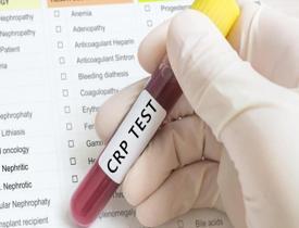 Kandaki CRP neden yükselir? CRP nedir? CRP nasıl düşürülür?