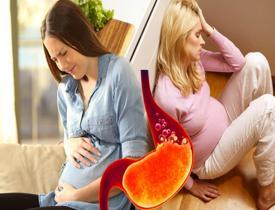 Hamilelikte mide yanması neden olur? Hamilelikte mide yanmasına ne iyi gelir?