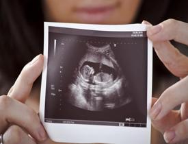 Gebelikte detaylı ultrason neden önemli? Uzmanı önerdi: Yüzde 70'i tespit ediliyor