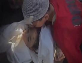 Gazze'deki o görüntüler yürekleri sızlattı! "Kardeşimin saç telini alabilir miyim?"