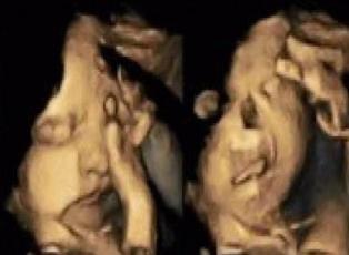 Sigara içen annenin bebeği ilk kez görüntülendi!