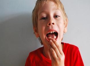 Çocuklarda ayrık dişlere dikkat!