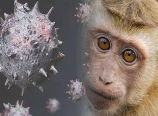 Maymun çiçeği virüsü nedir? Prof. Dr. Muhammed Emin Akkoyunlu açıklıyor