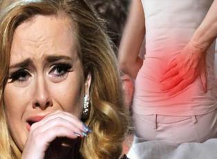 Adele'in yakalandığı siyatik hastalığı nedir? Siyatik hastalığının belirtileri nelerdir? 