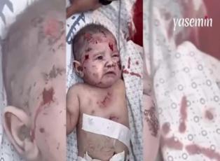 Gazze'de katliamın boyutu kan dondurdu! Gazzeli bebek girdiği şok yüzünden ağlayamadı