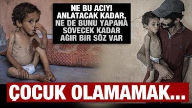 Gazzeli Ebu Ful açlıkla mücadele ediyor