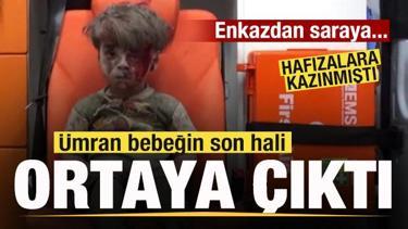 D&uuml;nya g&uuml;ndemine oturmuştu! &Uuml;mran bebeğin son hali ortaya &ccedil;ıktı!