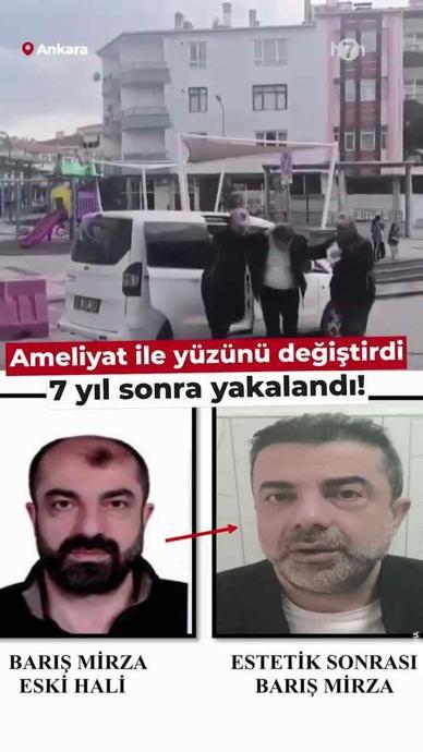 Y&uuml;z&uuml;n&uuml; değiştirdi 7 yıl sonra yakalandı!