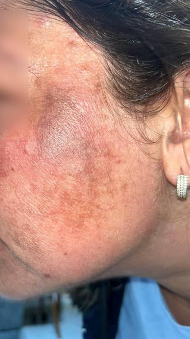 G&uuml;zelleşmek istedi: &Ccedil;ocuğu korkup ka&ccedil;ıyor