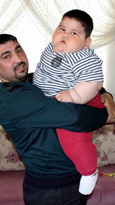 11 yaşında 50 kilo verdi