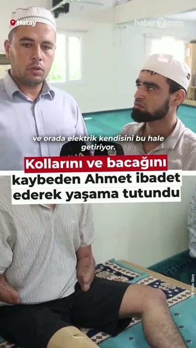 Kollarını ve bacağını kaybetti