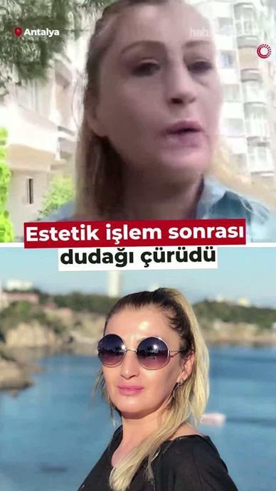 "G&uuml;l&uuml;ş&uuml;m yok, yemek yemek zor."