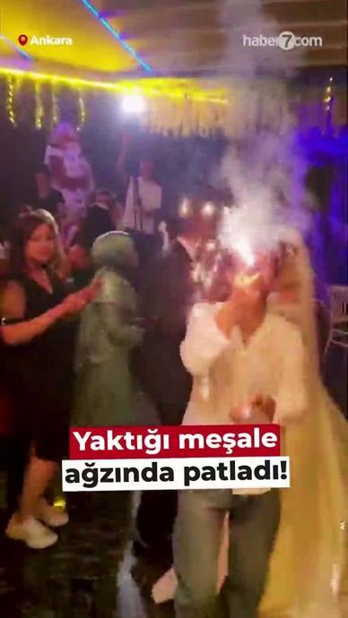 Yaktığı meşale ağzında patladı!