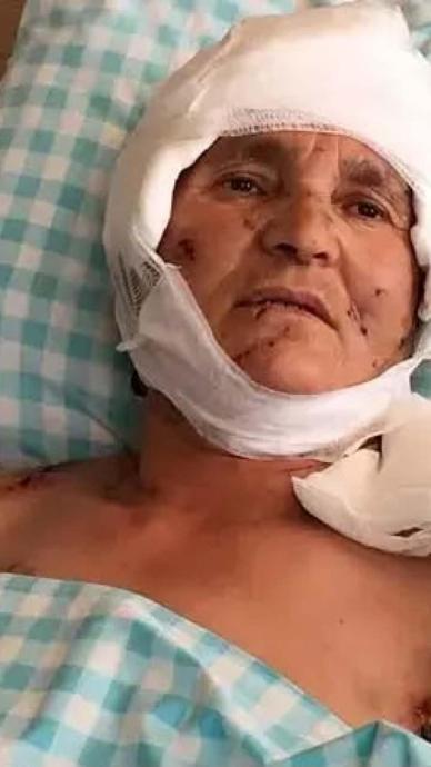 K&ouml;pekler par&ccedil;alamıştı: Tazminat kararı!