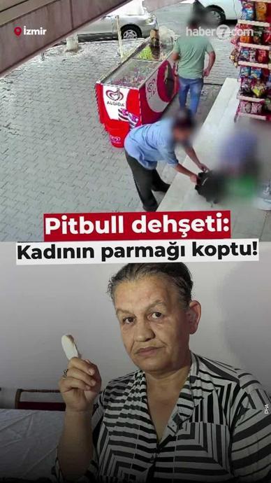 Pitbull, kadının parmağını kopardı!