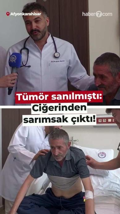 Ciğerinden sarımsak &ccedil;ıktı!