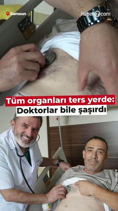T&uuml;m organları ters yerde: Doktorlar bile şaşırdı