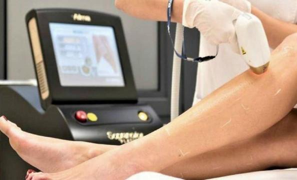 buz lazer epilasyon nedir buz lazer epilasyon ise yariyor mu guzellik haberleri